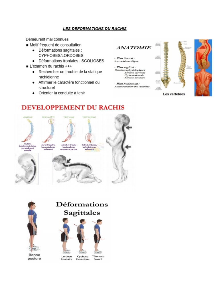 Déformations du rachis : Cyphoses et scolioses | PDF | Scoliose ...