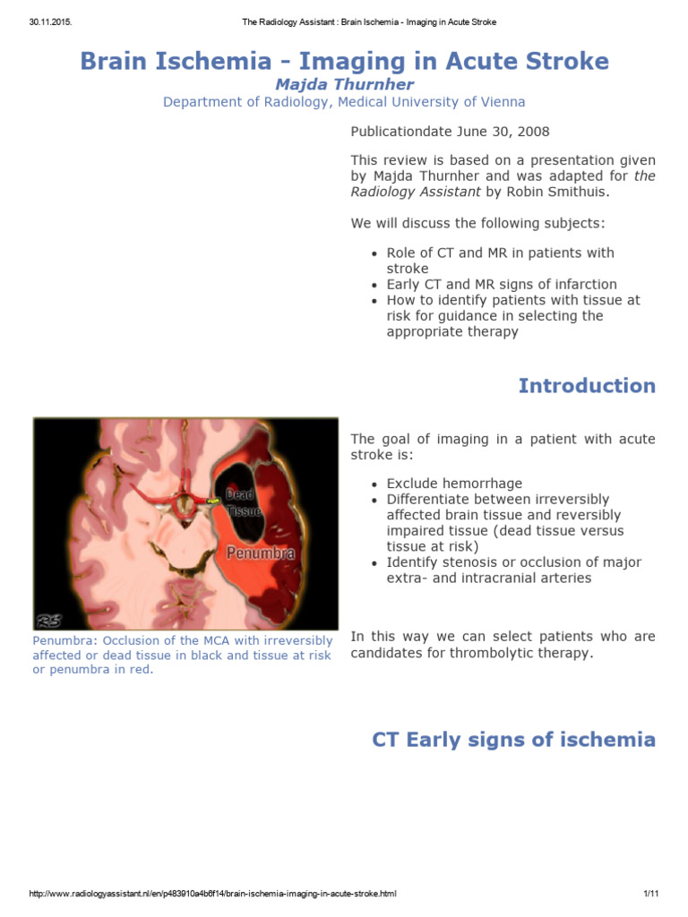 Imaging Brain Ischemia in Stroke | PDF | Stroke | Ischemia