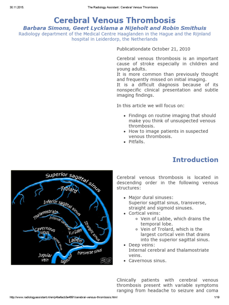 Cerebral Venous Thrombosis Insights | PDF | Thrombosis | Vein