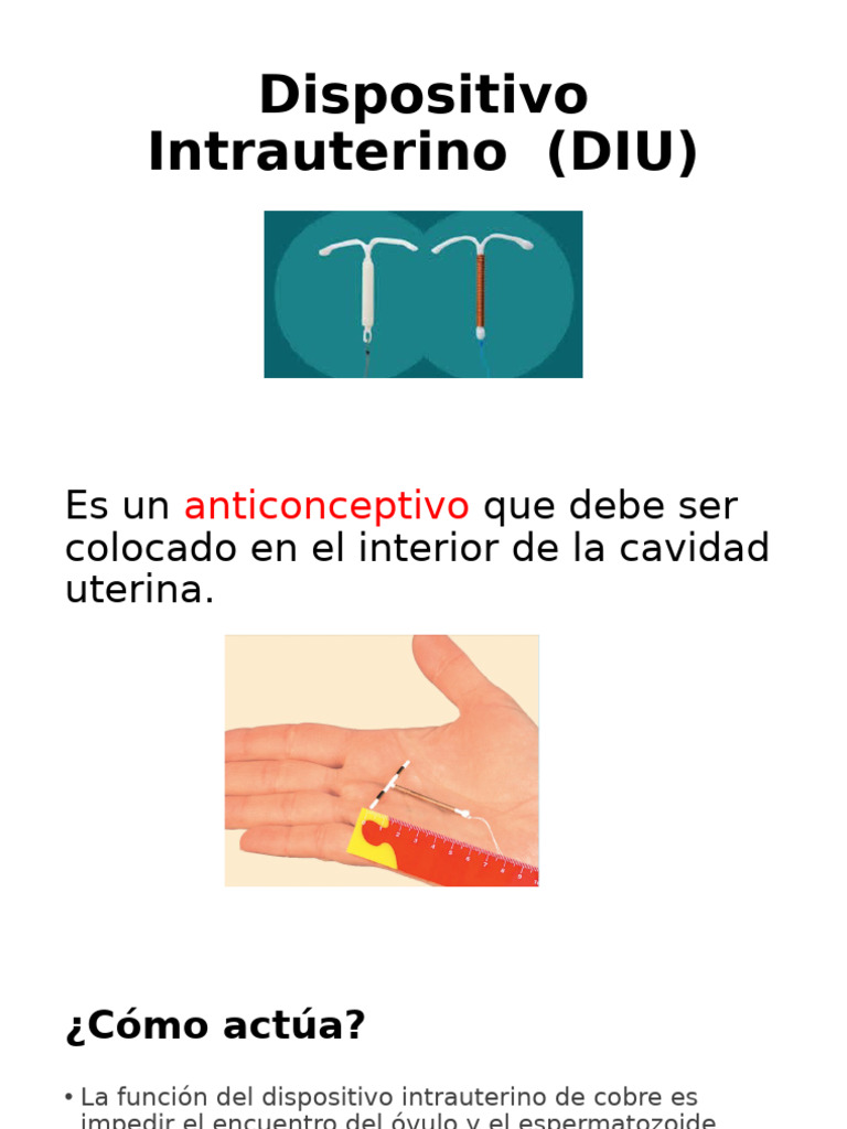 Dispositivo Intrauterino (DIU) | PDF | Control de la natalidad | Útero