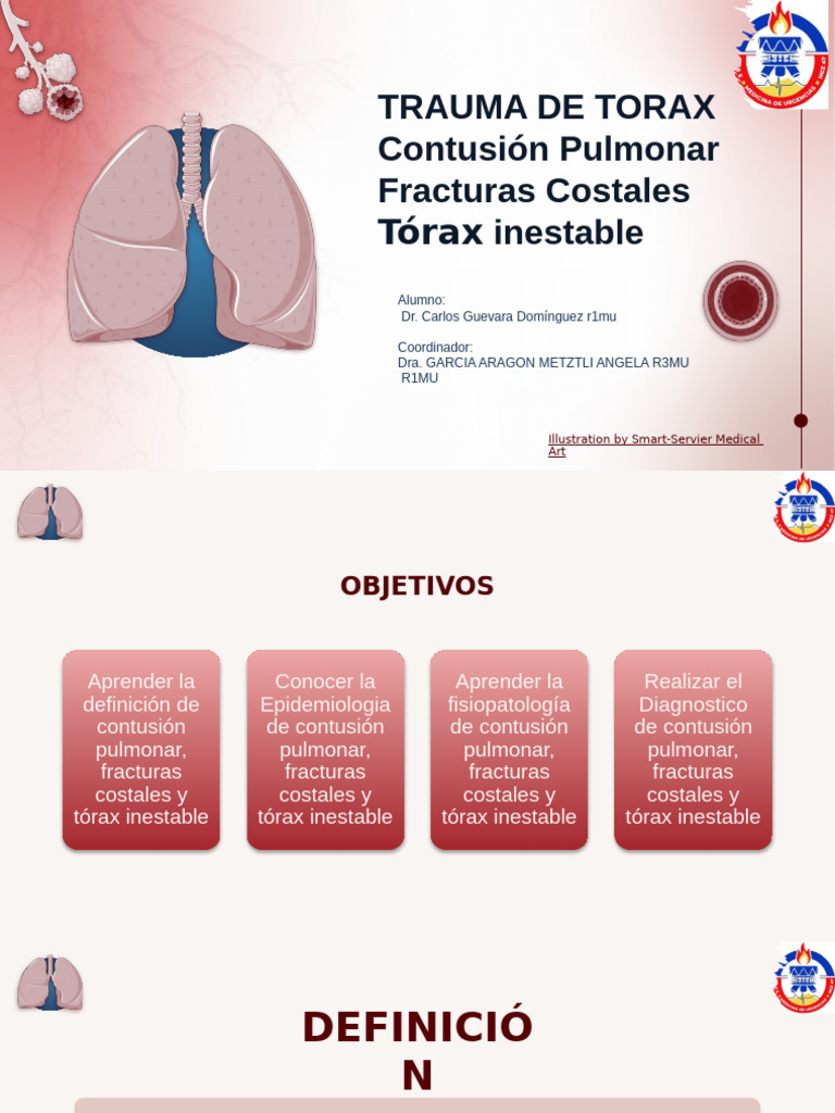 Trauma de Tórax: Contusión y Fracturas | PDF | Tórax | Respiración