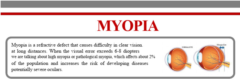 Understanding Myopia and Its Risks | PDF