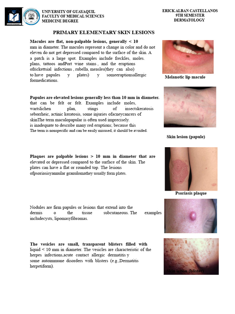 Overview of Primary Skin Lesions | PDF | Dermatitis | Psoriasis