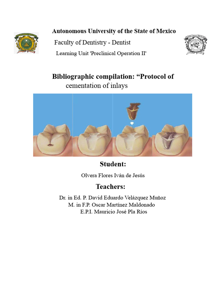 Cementation of Inlays and Crowns | PDF | Periodontology | Dentistry ...