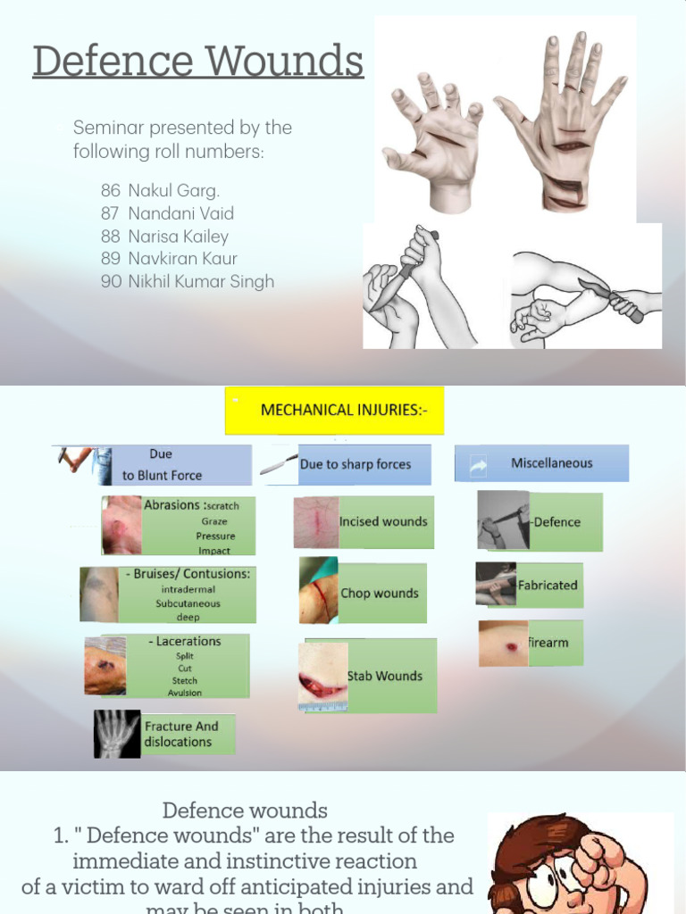Understanding Defence Wounds in Forensics | PDF | Diseases And ...