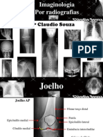 Aula 3- Imaginologia por radiografias, Joelho e perna. Profº Claudio Souza- ATUALIZADA mês05/12!!!!