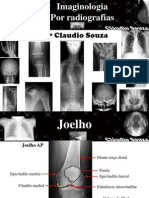 Aula 3 - Imaginologia Por Radiografias, Joelho e Perna. Profº Claudio Souza - ATUALIZADA Mês05/12!!!!