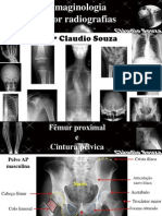 Aula 4 - Imaginologia Por Radiografias - Femur e Cintura Pelvica. Profº Claudio Souza - ATUALIZADA Mês05/12!!!!