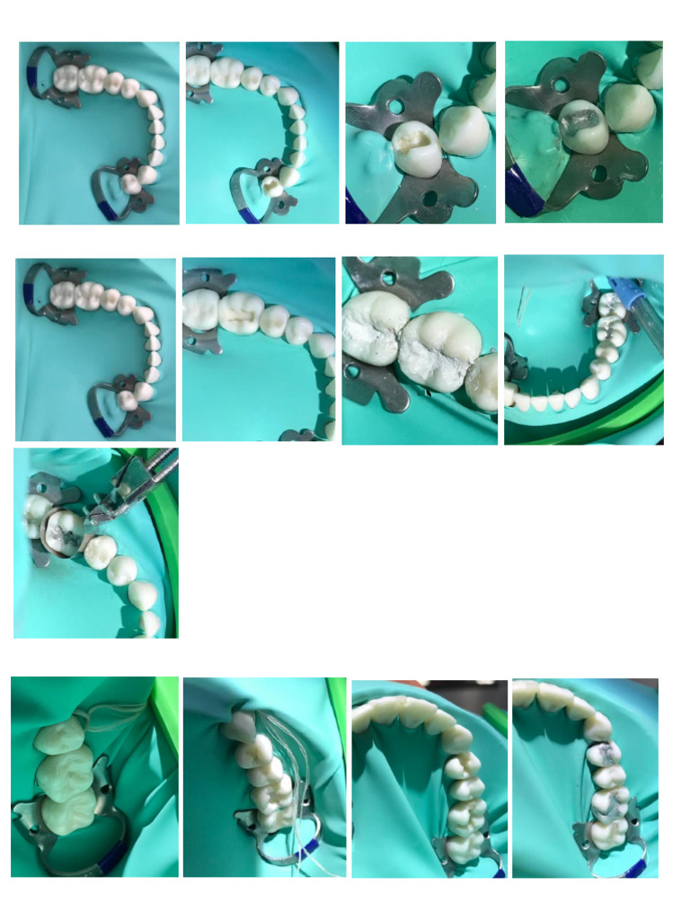 Amalgam As | PDF