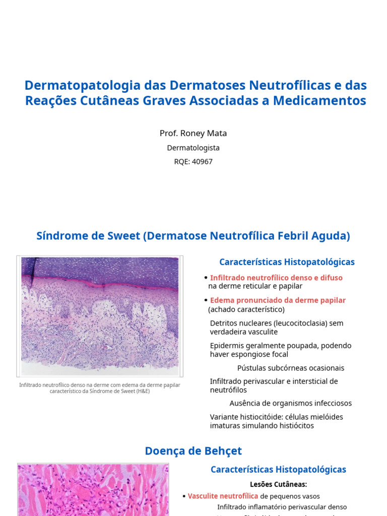 Dermatopatologia das Dermatoses Neutrofílicas | PDF | Epiderme | Pele