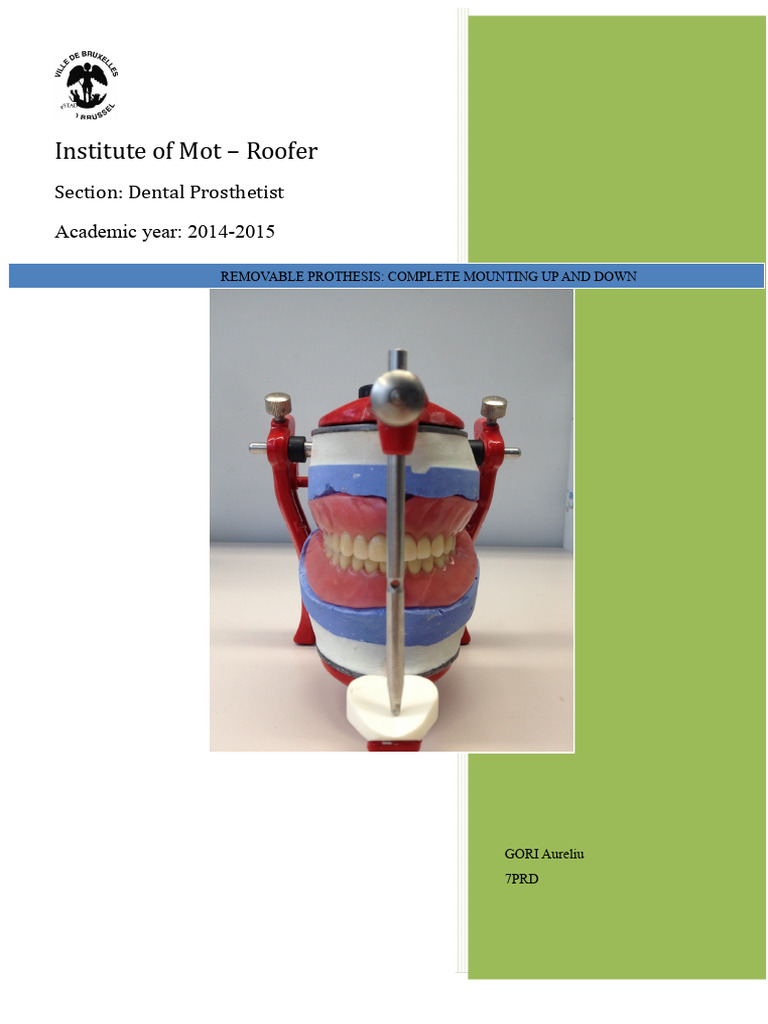 Complete Removable Prosthesis Guide | PDF | Dental Anatomy | Mouth