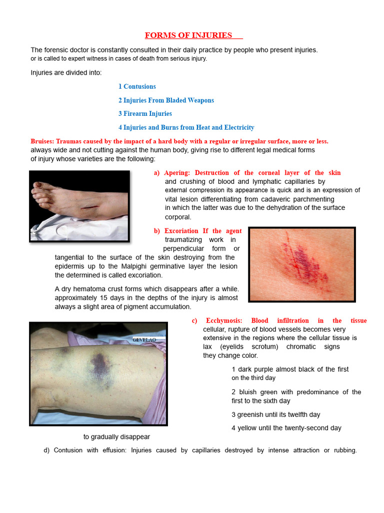 Forms of Injuries | PDF | Medical Emergencies | Injury