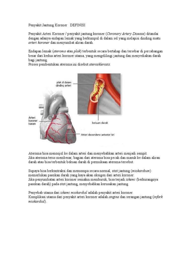 Penyakit Jantung Koroner