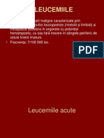 Leucemiile Acute