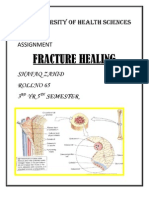 Fracture Healing: Dow University of Health Sciences