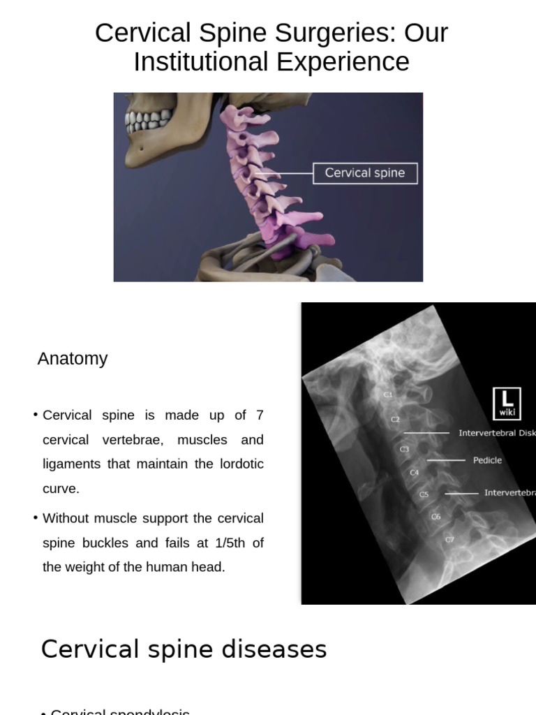 Cervical Spine Surgery Overview and Insights | PDF | Spinal Cord Injury ...