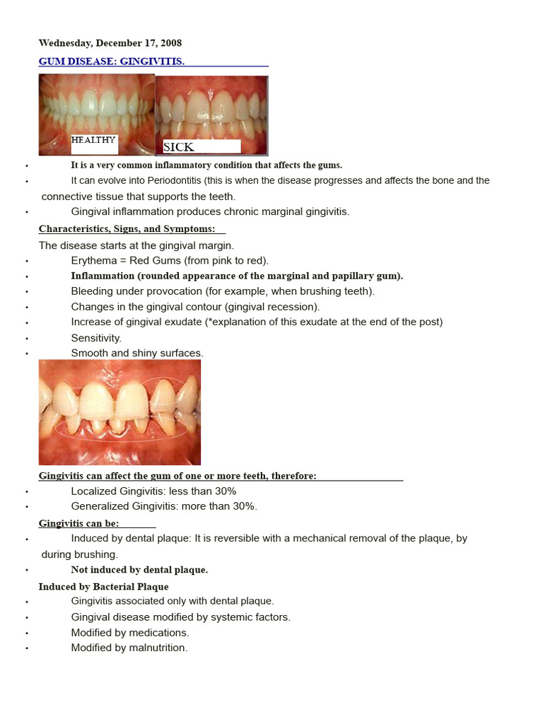 Gingivitis | PDF | Periodontology | Medical Specialties