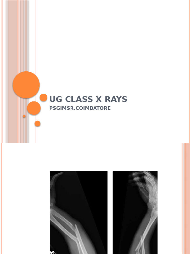 Ug Class X Rays | PDF