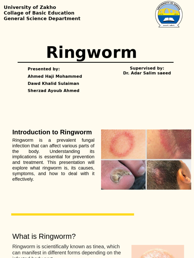 Ringworm Causes Symptoms And Treatment 630x1120