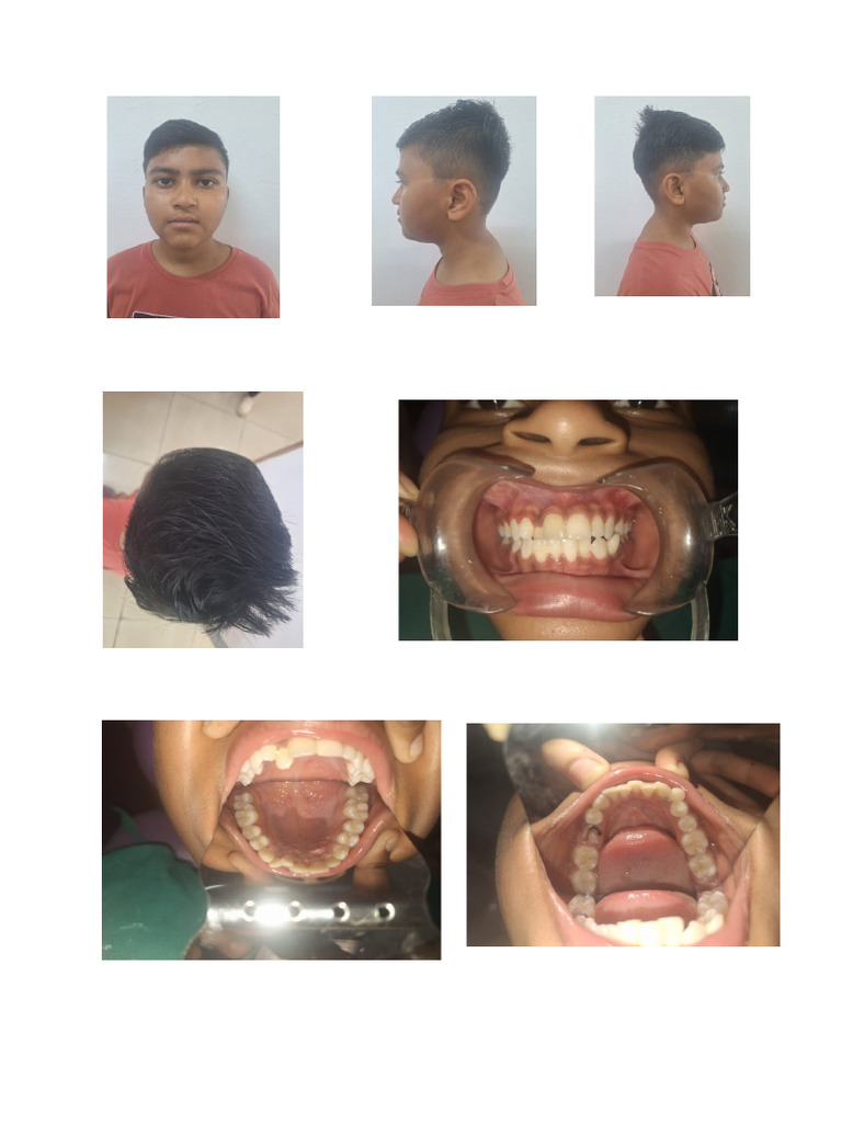 MT Samit | PDF