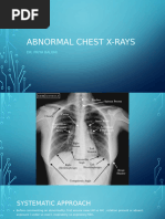 Hilum Overlay Sign in Chest Imaging | PDF