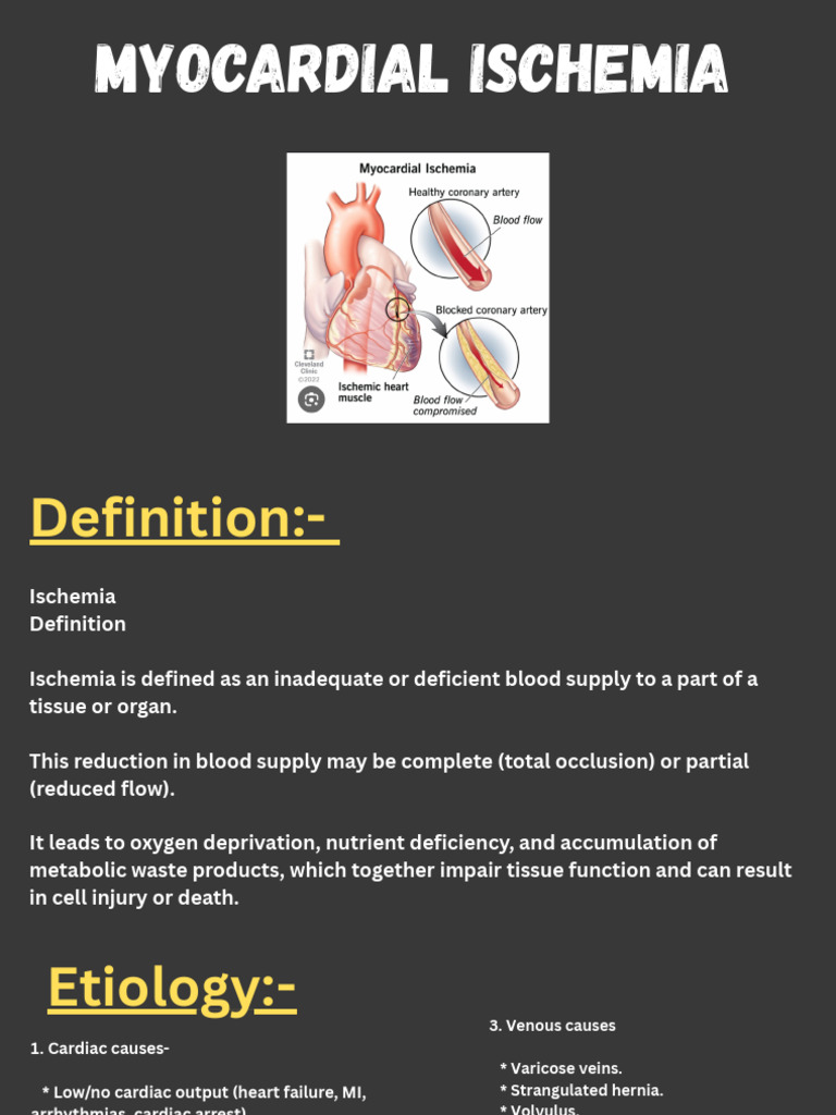 Myocardial Infarction - 20250918 - 095938 - 0000 | PDF | Ischemia ...