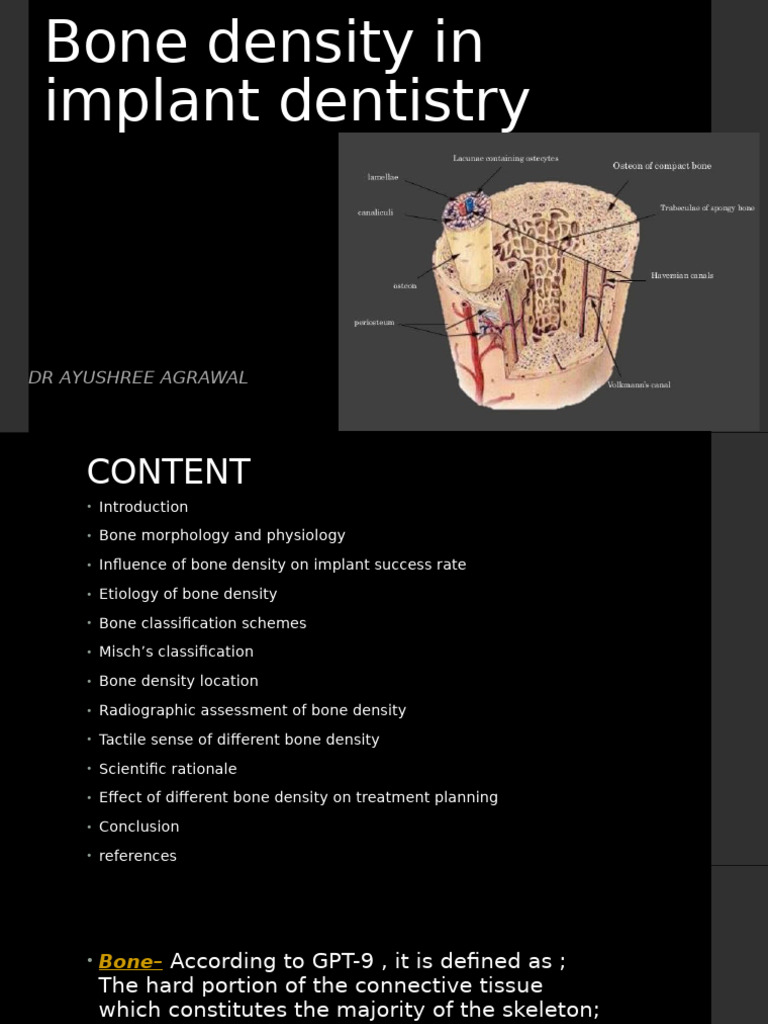 Bone Density in Implant Dentisty | PDF | Bone