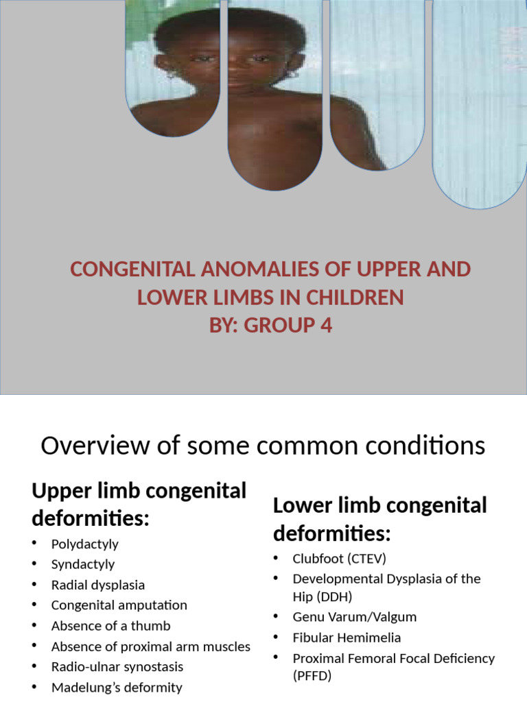 Congenital Limb Anomalies in Children | PDF | Limbs (Anatomy ...