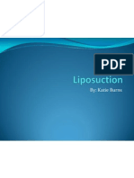 Liposuction Power Point