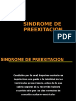 Sind de Preexitacion