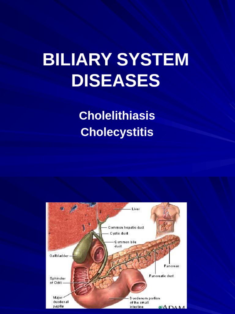 FT4y Lect2 Cholelythiasis. Chronic Cholecistitis MangilevaTA | PDF ...