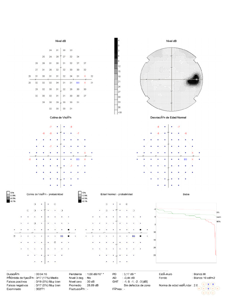 CVC | PDF