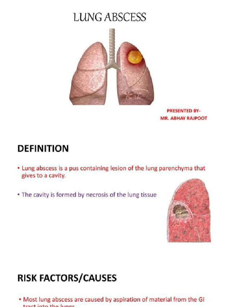 Lung Abscess | PDF