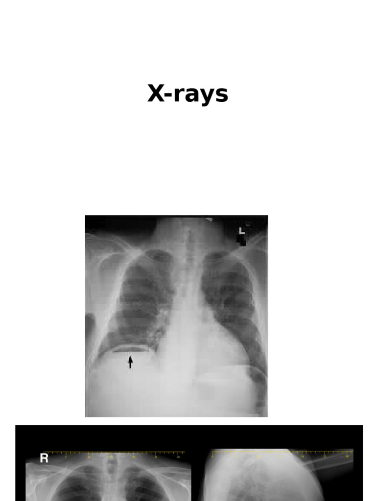 X Rays | PDF