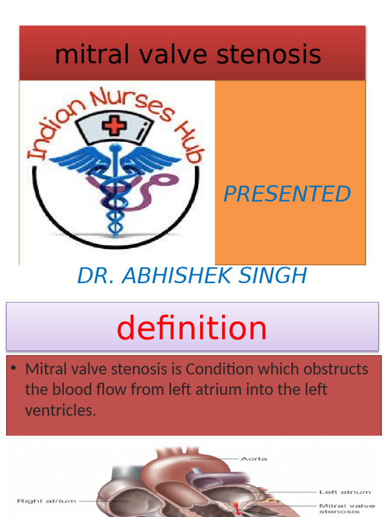 Mitral Valve Stenosis Overview and Management | PDF