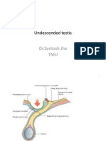 Undescended Testis: DR - Santosh Jha TMU