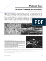 Pictorial Essay: Sonography of Peripheral Nerve Pathology