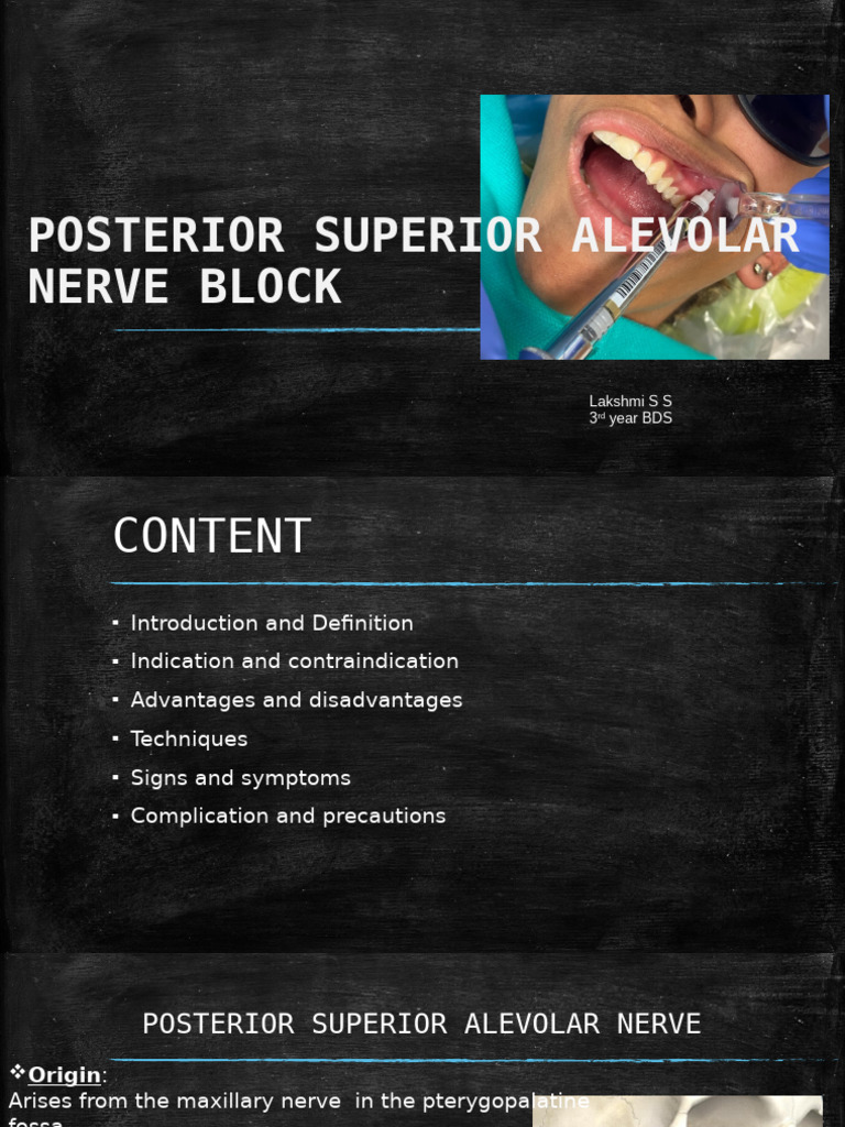 Posterior Superior Alveolar Nerve Block Guide | PDF | Medical Specialties