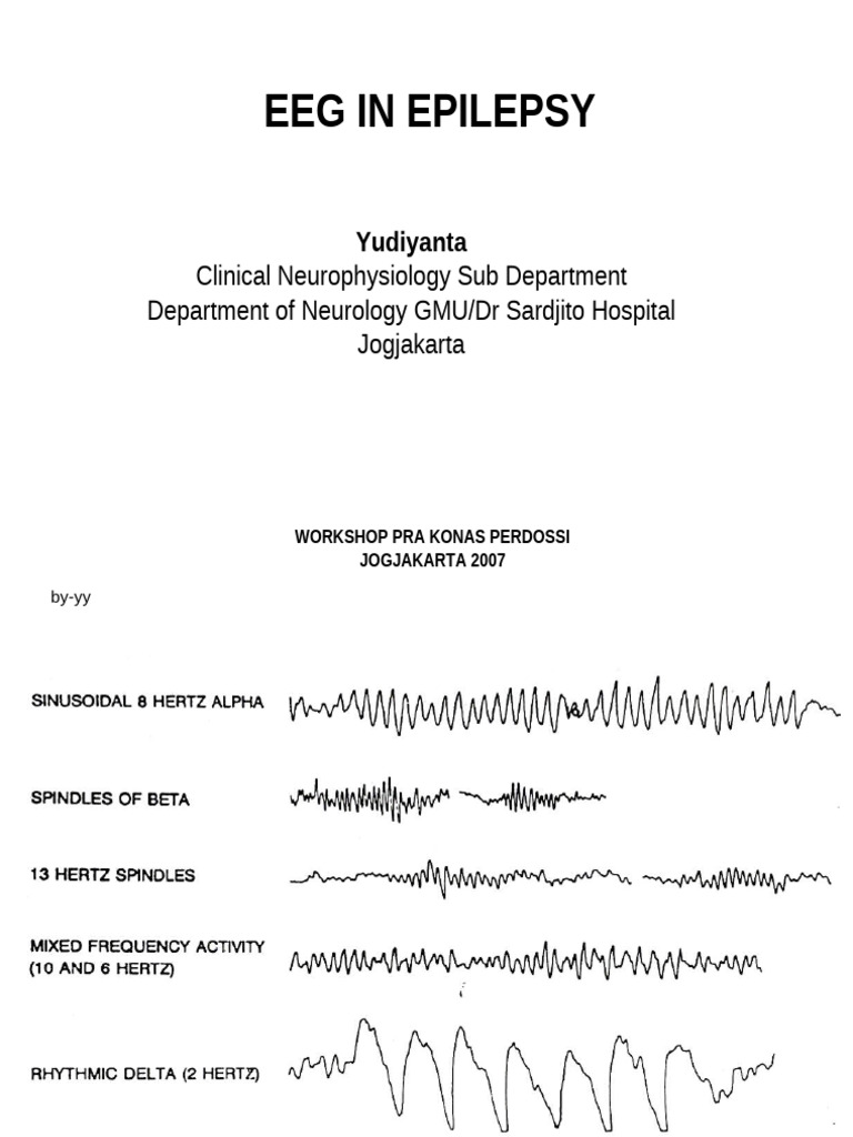 EEG Analysis in Epilepsy Workshop | PDF | Epilepsy | Electroencephalography