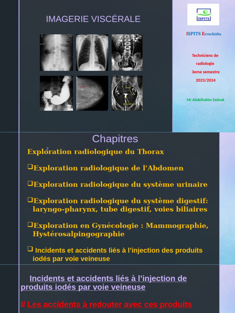 Incidents liés à l'injection de produits iodés | PDF | Corticoïde ...
