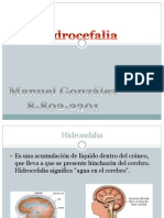 Hidrocefalia