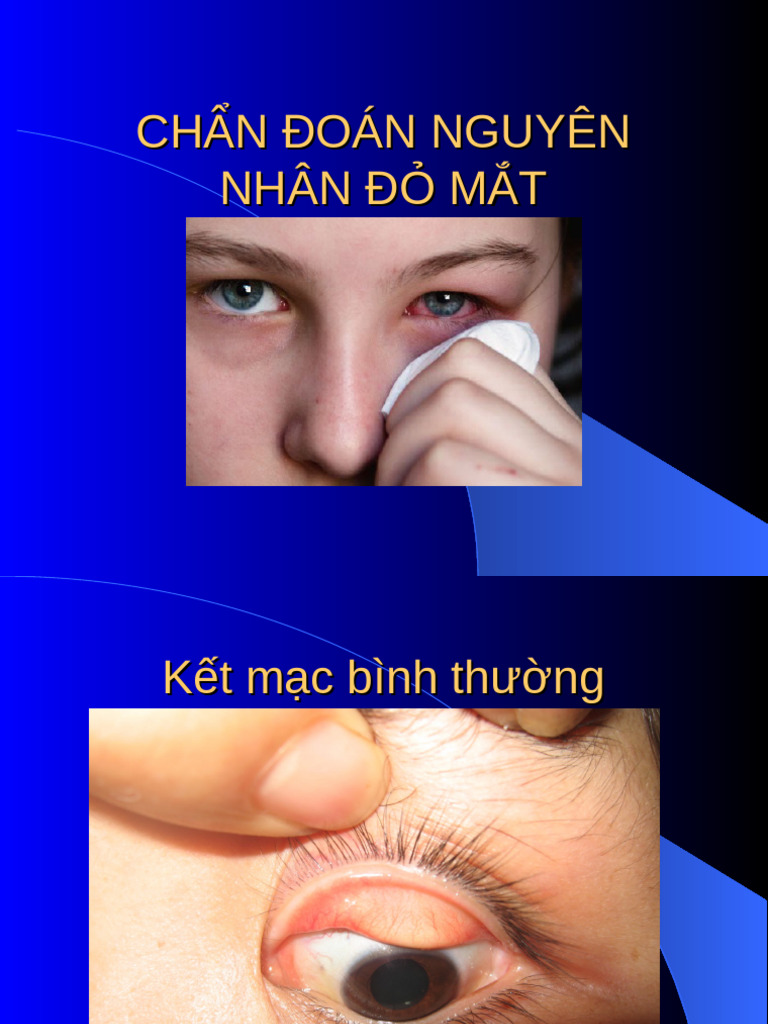 Do Mat | PDF