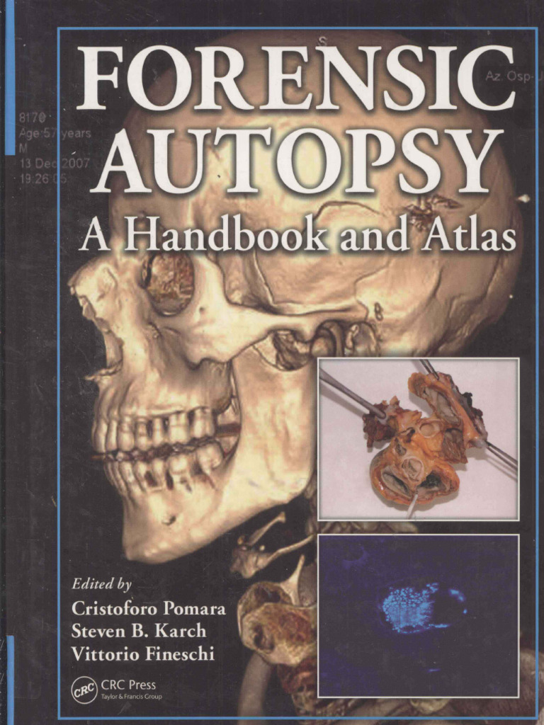 Forensic Autopsy - A Handbook and Atlas - Edited by Cristoforo Pomara ...