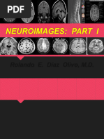 CT Scan Brain Procedure Codes Overview | PDF | Headache | Dementia