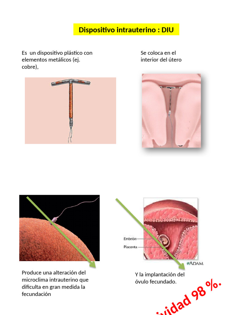 Dispositivo Intrauterino: DIU | PDF