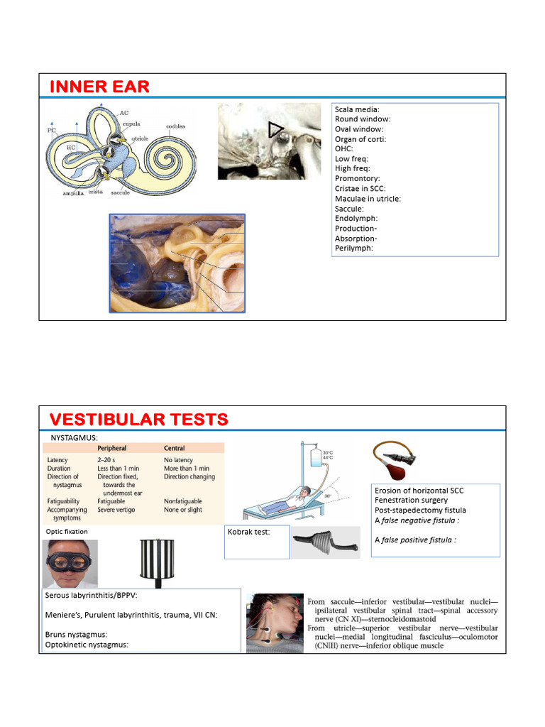 Inner Ear Anatomy and Vestibular Tests | PDF | Diseases And Disorders ...