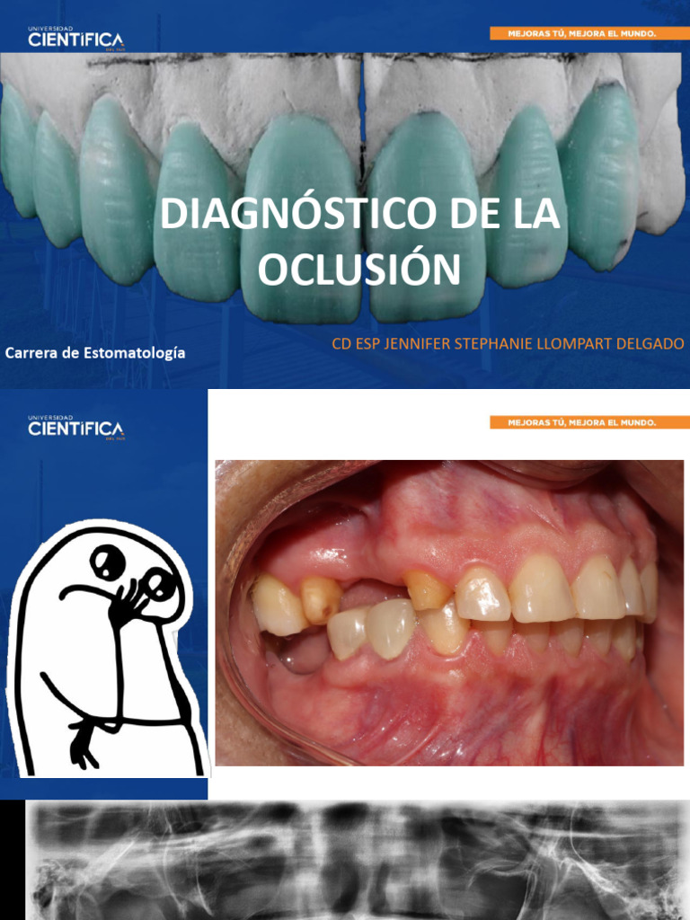 Diagnóstico y Tratamiento de Oclusión | PDF | Odontología | Articulación