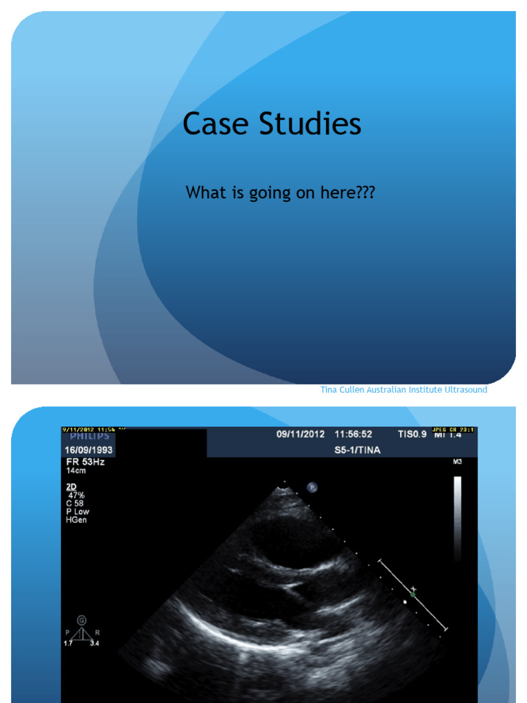 Day 1 Case Study 1 Echo | PDF