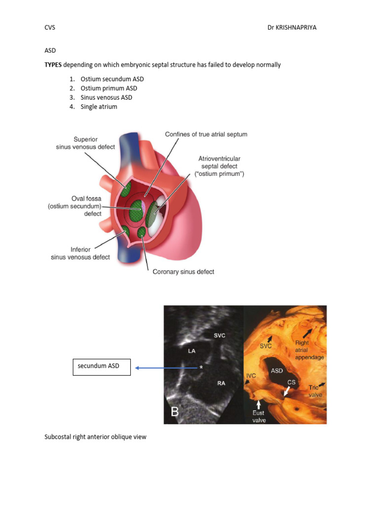 Atrial Septal Defect Overview and Management | PDF | Atrium (Heart ...