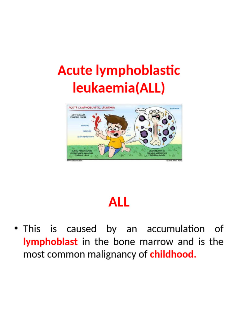 Acute Lymphoblastic Leukaemia (ALL) | PDF | Leukemia | Clinical Medicine